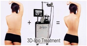 Hút mỡ bằng công nghệ Ultra Lipo 3D an toàn nhất